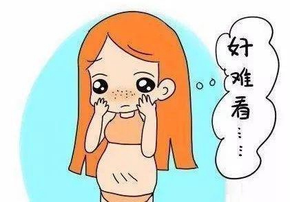 孕妇贫血可以顺产么女性？孕妇贫血严重要怎么办？